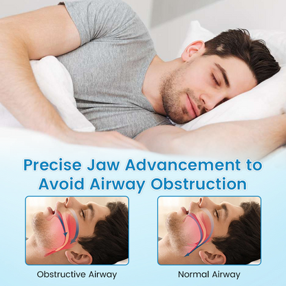 ✨QIAWI™ PerfectSleep Solution- Anti-Snoring & Anti-Grinding Teeth Protector